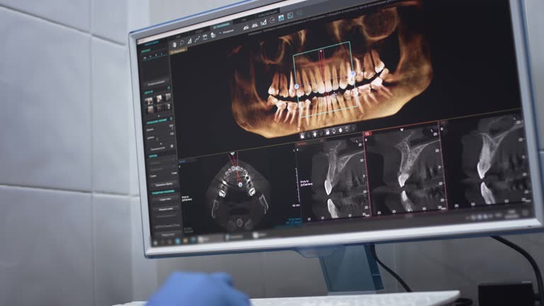 Dental X-Rays and Imaging in Boonville, IN